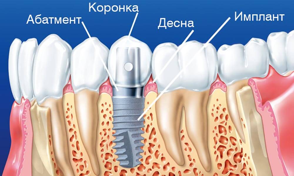 Хирургическая стоматология